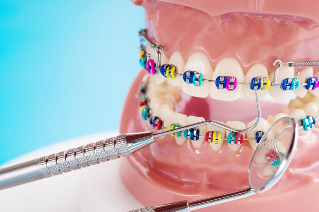 Bethlehem Orthodontist